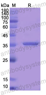 Recombinant Human DBI Protein, N-GST