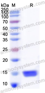 Recombinant Human FABP1 Protein, N-His