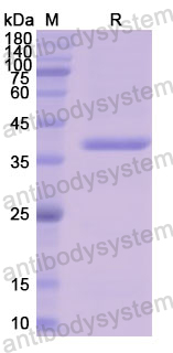 Recombinant Human LDHB Protein, N-His