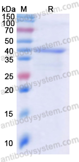 Recombinant Human NEFL Protein, N-His