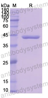 Recombinant Human NEFM Protein, N-His