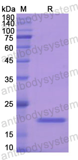 Recombinant Human GPX1 Protein, N-His