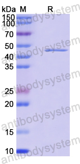 Recombinant Human PGK2 Protein, N-His