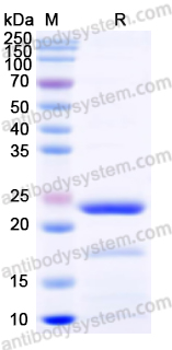 Recombinant Human PROS1 Protein, N-His