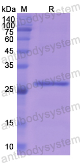 Recombinant Human ASGR1 Protein, N-His