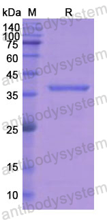 Recombinant Human ASGR2 Protein, N-His