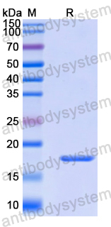 Recombinant Human ASGR2 Protein, N-His