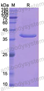 Recombinant Human ACYP1 Protein, N-GST