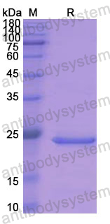 Recombinant Human ADH1A Protein, N-His