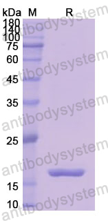 Recombinant Human CTSD Protein, N-His