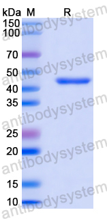 Recombinant Human CTSD/Cathepsin D Protein, N-His