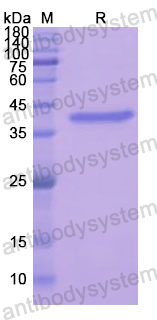 Recombinant Human ANXA2 Protein, N-His