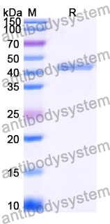 Recombinant Human C8A Protein, N-His