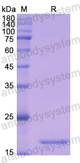 Recombinant Human CD42b/GP1BA Protein, N-His