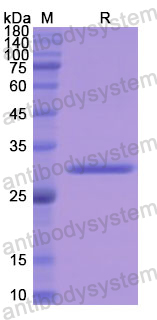 Recombinant Human TUBB/Tubulin beta Protein, N-His