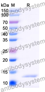 Recombinant Human TUBB Protein, N-His