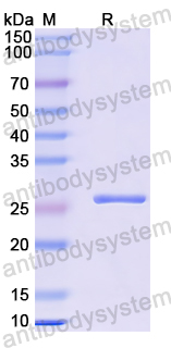Recombinant Human CA3/Carbonic anhydrase 3 Protein, N-His