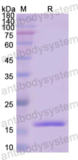 Recombinant Human IVL Protein, N-His