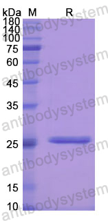 Recombinant Human PRSS1 Protein, N-His