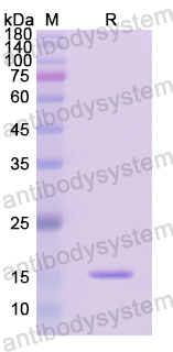 Recombinant Human GRP Protein, N-His