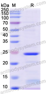 Recombinant Human CSN3 Protein, N-His