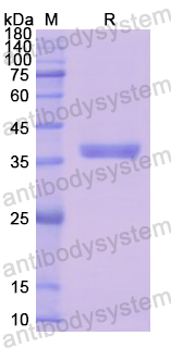 Recombinant Human DCN Protein, N-His