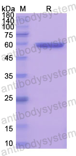 Recombinant Human PSAP Protein, N-His