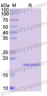 Recombinant Human HEXB Protein, N-His