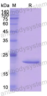 Recombinant Human CTSL Protein, N-His