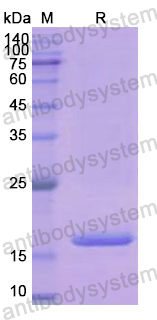 Recombinant Human PFN1 Protein, N-His