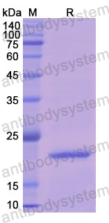 Recombinant Human APRT Protein, N-His