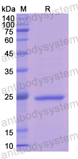 Recombinant Human EPRS1 Protein, N-His