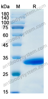 Recombinant Human CTSB Protein, N-His