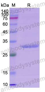 Recombinant Human UMOD Protein, N-His