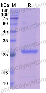 Recombinant Human LAMB1 Protein, N-His