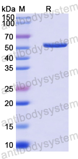 Recombinant Human YES1 Protein, N-His