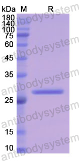 Recombinant Human LYN Protein, N-His