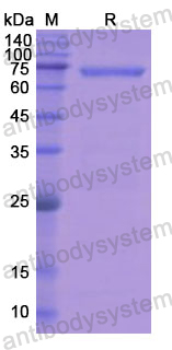 Recombinant Human RET Protein, N-His