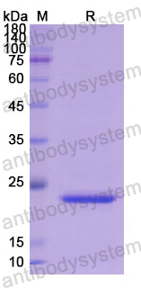 Recombinant Human SFTPB Protein, N-His