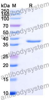 Recombinant Human SFTPB Protein, N-GST & C-His