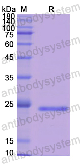 Recombinant Human THBS1 Protein, N-His