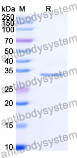 Recombinant Human GJB1 Protein, N-GST & C-His