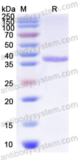 Recombinant Human SP1 Protein, N-His