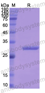 Recombinant Human COL1A2 Protein, N-His