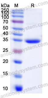 Recombinant Human ANXA6 Protein, N-His