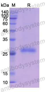 Recombinant Human GLI1 Protein, N-His