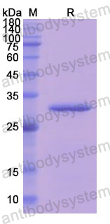 Recombinant Human CD55 Protein, N-His