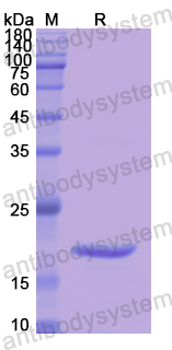 Recombinant Human SERPINA6 Protein, N-His