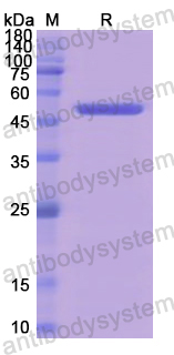 Recombinant Human NR3C2 Protein, N-GST