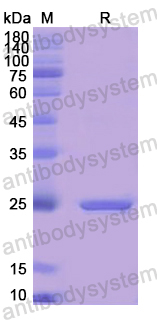 Recombinant Human GUSB Protein, N-His